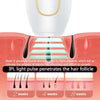 IPL Laser Hair Removal