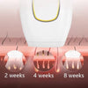 IPL Laser Hair Removal